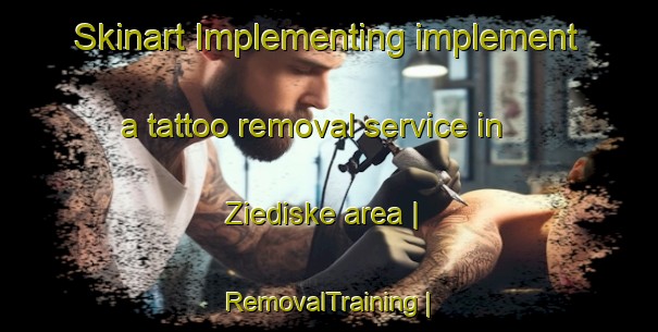 Skinart Implementing implement a tattoo removal service in Ziediske area | RemovalTraining | RemovalClasses | SkinartTraining-Lithuania